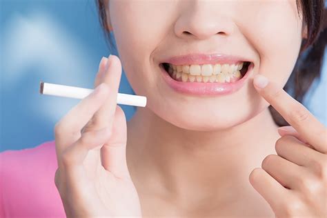 what smoking does to your teeth and gums