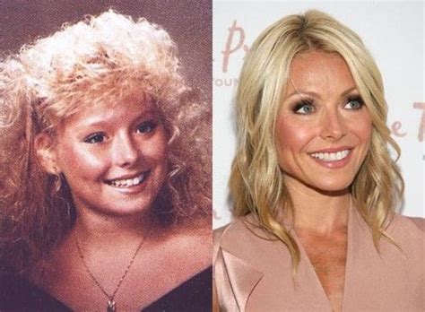 Kelly Ripa Plastic Surgery Before And After Pictures Plastic Surgery