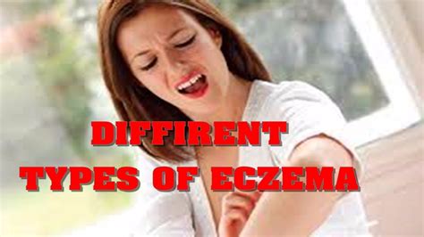 Clear Up Eczema Diffrent Types Of Eczema Youtube