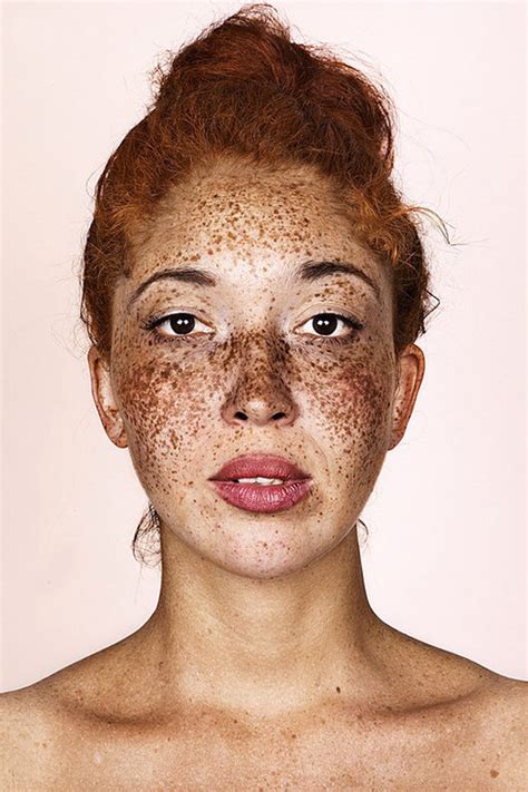 Brock Elbanks Freckles Shows Off The True Beauty Of Having Freckles Metro News