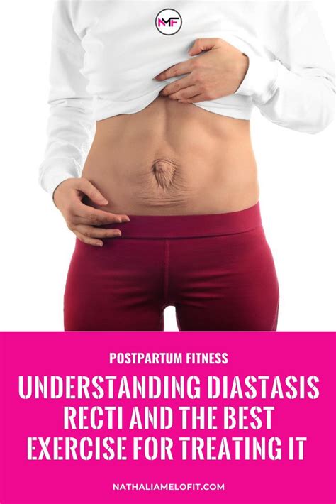 Understanding Diastasis Recti And The Best Exercise For Treating It