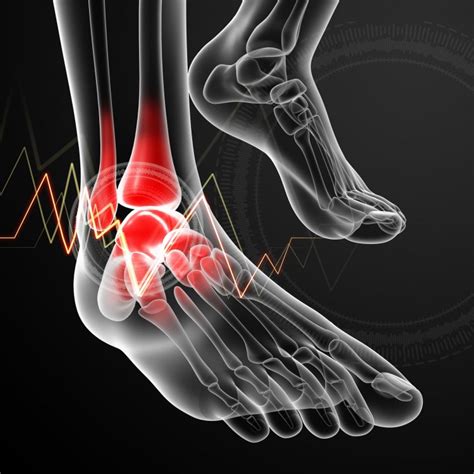 5 Different Types Of Arthritis That Affect Your Feet Ankle Surgery In