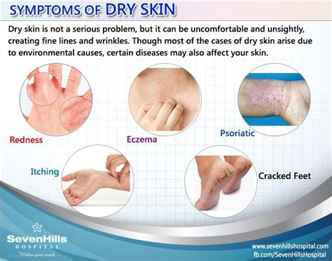 Symptoms Of Dry Skin Dryskin Symptomsdryskin Dry Skin Symptoms