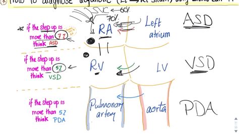 Formation of the right and left atria: How to diagnose acyanotic heart diseases (Left to Right ...