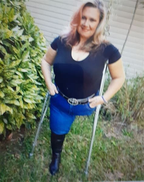Pinterest Disabled Women Women Amputee