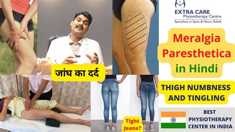 Meralgia Paresthetica In Hindi Thigh Numbness Burning Hot Sex Picture