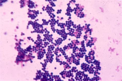 Staphylococcus Aureus Under Microscope Staphylococcus Aureus Gram