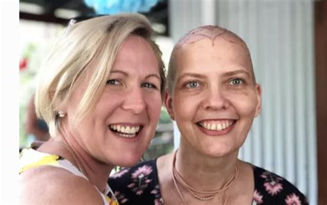 Carol Shaves Her Head Head Shave Fundraising Story Acrf