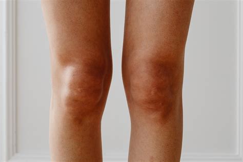 Stabbing Knee Pain At Night Online Sales Save 51 Jlcatj Gob Mx