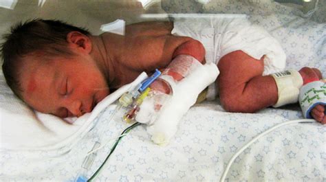 Nicu Equipment Everything You Need To Know About Premature Babies And