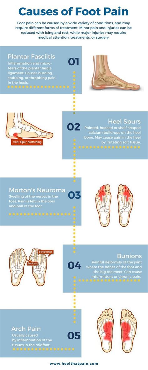Foot Pain Chart Do You Know Whats Causing Your Foot Pain It May Be