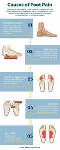 Foot Chart Do You Know What 39 S Causing Your Foot It May Be