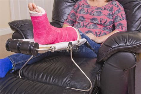 Broken Leg And Crutches And Support Stock Image Image Of Ankle