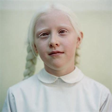 Pin By Aiza Mirgan On Amazing Albinos Albino Dark Aesthetic Albinism