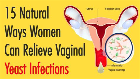 Yeast Infection In Women