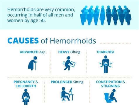 Hemorrhoids Diagnosis Granite Peaks Gastroenterology Of Utah