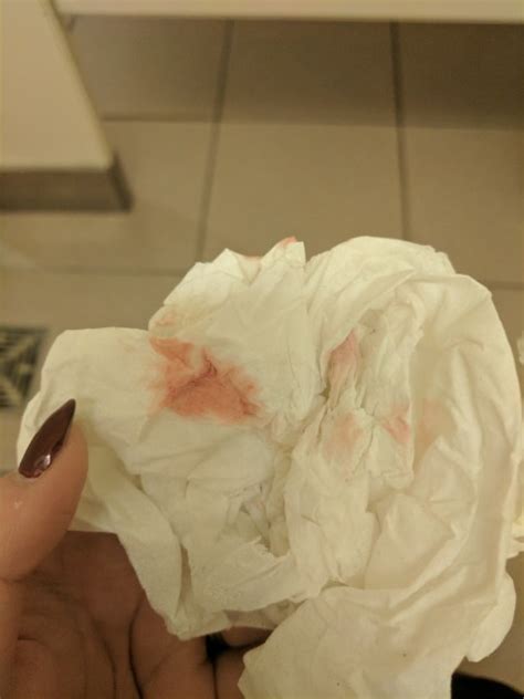 Implantation Bleeding Af Or Chemical Please Help Tmi Toilet Paper