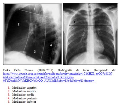 Blog De Anatomía Radiológica Humana Unad Grupo 15400340 2018 2018