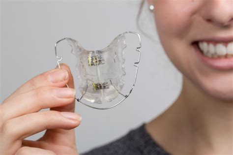 From gaps to overbites, to teeth or jaw alignment there are many factors that can affect the duration a patient will need to wear braces. Pin on Orthodontic Blog Posts