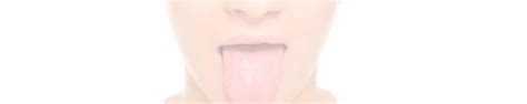 What Is A Tongue Thrust Habit Align Dentistry Blog Call 02 9723 5757
