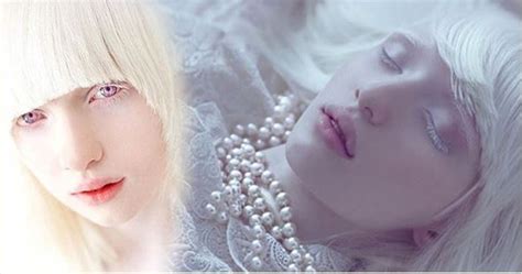 Meet Nastya Zhidkova The Most Beautiful Albino Girl In The World