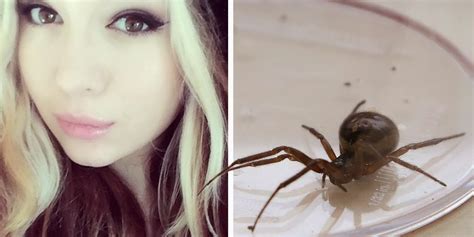False Widow Spider Bites Arachnophobic Teenager Charley Porter Seven Times Huffpost Uk