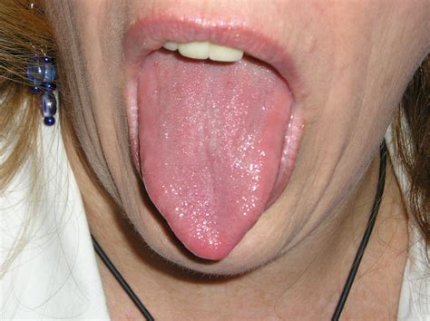 of a thought or idea about to be said or almost remembered. Look at your tongue, check your health