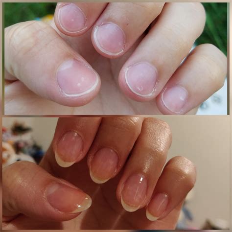 Before And After Just A Clear Coat To Show How My Nail Shape Has