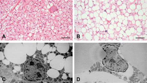 Interscapsular Brown Adipose Tissue A And B Hematoxylin And Eosin