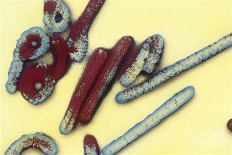 Since the first aids cases were reported in 1981, hiv/aids has been one of humanity's deadliest and most persistent epidemics. Marburg Virus Tem Photograph by Scott Camazine