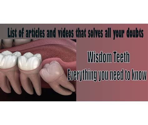 Virtual Library Wisdom Teeth Everything You Need To Know Odontovida