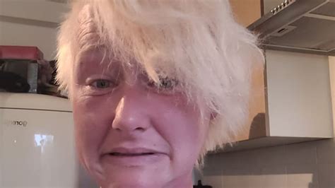 Woman Forced To Shave Off All Her Hair After Home Dye Bleach Job Goes