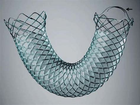 The Partially Covered Biliary Wallflex Self Expanding Metal Stent With