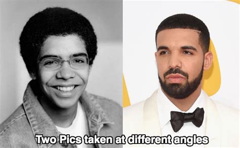 Drake Nose Job Before And After Photos Latest Plastic Surgery Gossip