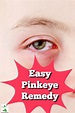 Pinkeye: The Fastest and Easiest Home Remedy | Pinkeye remedies, Pink ...