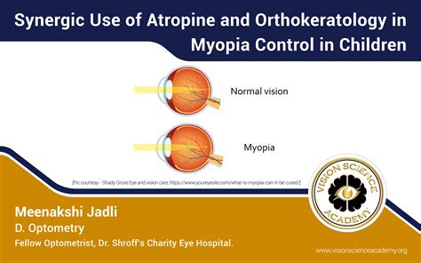 Synergic Use Of Atropine And Orthokeratology In Myopia Control In