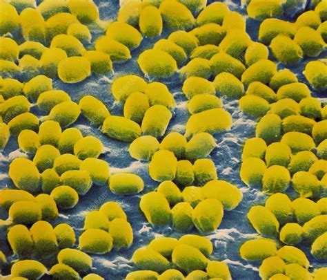 Anthrax Bacteria Spores Stock Image B2200901 Science Photo Library