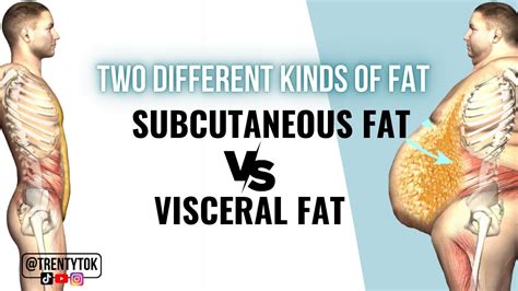 Two Different Kinds Of Fat Subcutaneous Fat Vs Visceral Fat Youtube