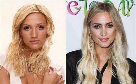 Ashlee Simpson Before And After Plastic Surgery Nose Face Lips