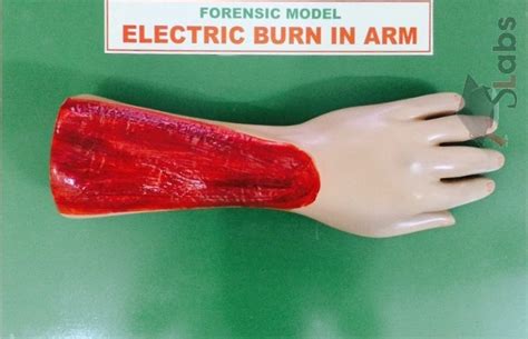 Electric Burn In Arm Scholars Labs
