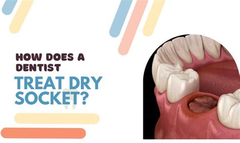 What Does Dry Socket Look Like After Wisdom Tooth Extraction