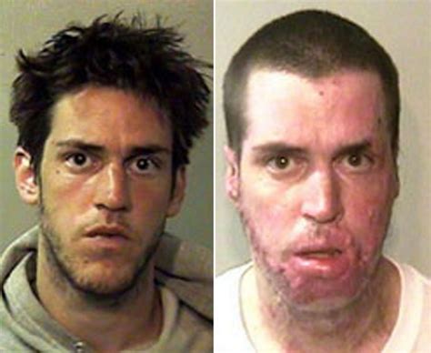 Faces Of Meth Campaign Reveal Shocking Images Of Addi Vrogue Co