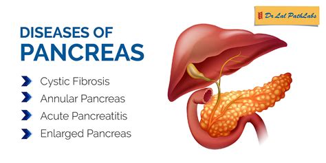 Pancreas Functions Diseases And Diagnosis Dr Lal Pathlabs Blog