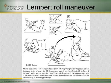 An Instruction Manual For How To Use The Lempet Roll Maneuver