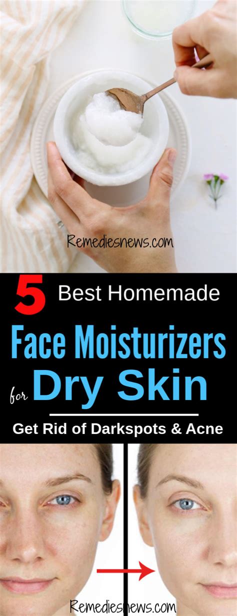 5 Best Diy Face Moisturizers For Dry Skin How To Use Them