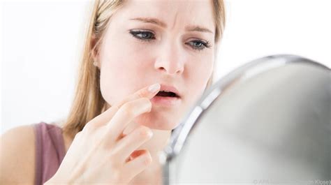 Hartnäckigen eingerissenen Mundwinkeln auf den Grund gehen SN at