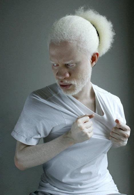 Pin By Hillary Shai On Albinos In 2020 Albino Men Human Poses