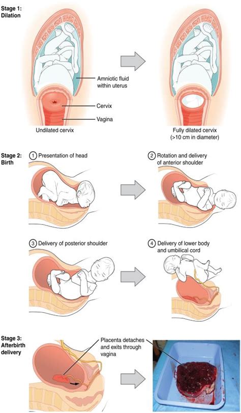 Cervix Opening During Labor