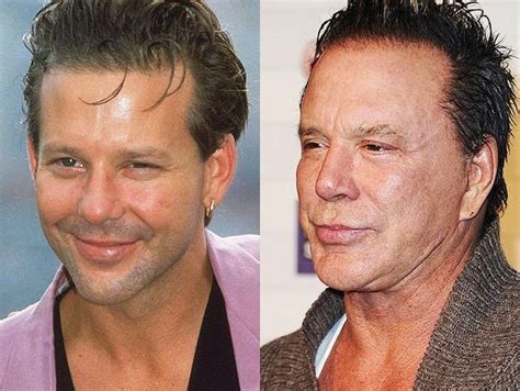 Celebrities Epic Face Lift Failures Mickey Rourke Plastic Surgery Celebrity Plastic Surgery
