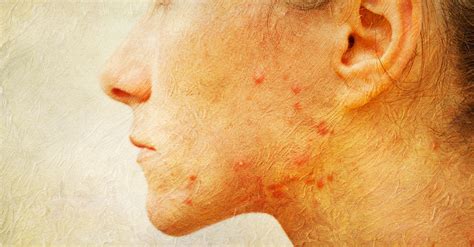 Types Of Skin Infections You May Face And What Causes Them